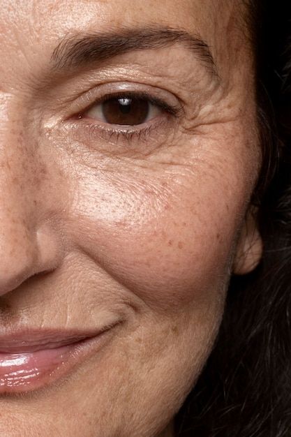 skin laxity in middle age woman