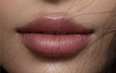 Can you get lip filler that no one can spot?